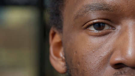 Macro shot of man showing half of face and one eye, looking at camera, having natural healthy...