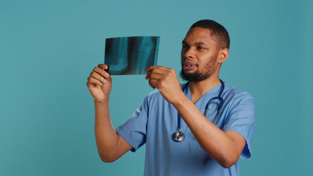Male nurse analyzing radiology x ray scan to provide patient with diagnosis during medical exam, studio background. Practitioner doing body examination, scanning radiography, camera Aの写真素材