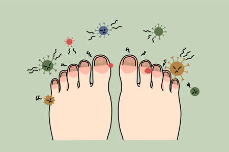 Unhealthy foot with nail infection or virusのイラスト素材