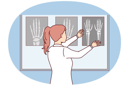 Woman surgeon applies X-ray of hand to luminous board to see sites of bone fracture. Vector imageのイラスト素材