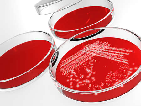 Petri dish with bacteria isolated on white background