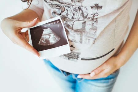Close-up of a woman with pregnant belly, holding ultrasound image. The young expecting mother overview. Maternity and pregnancy, health care concept.の写真素材