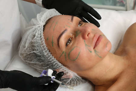 Patient at the procedure with green markings on the face