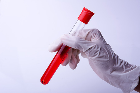 Hand with latex glove holding blood sample tubeの写真素材