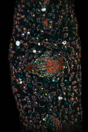 Mistletoe cross-section in the dark field 100x