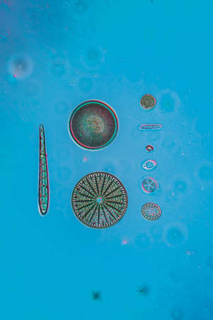 tiny microscopic diatoms in drops of waterの写真素材