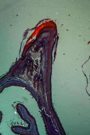 Beak tip of a young bird greatly enlarged 50x