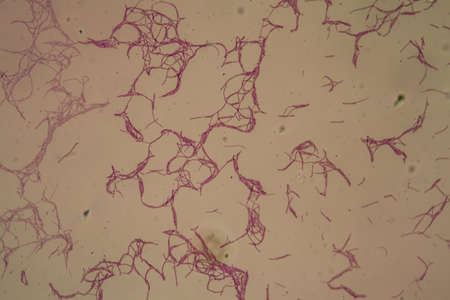 Bacillus anthracis anthrax under the microscope 200x