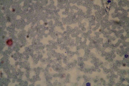 Malaria parasites in red blood cells under the microscope 400xの写真素材