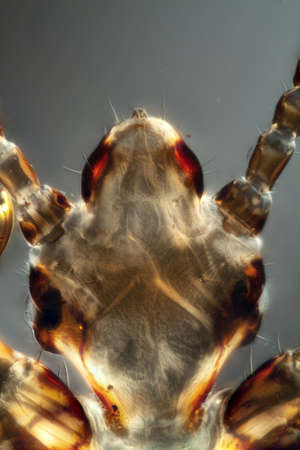 Head of the head louse with sucking mouth toolsの写真素材