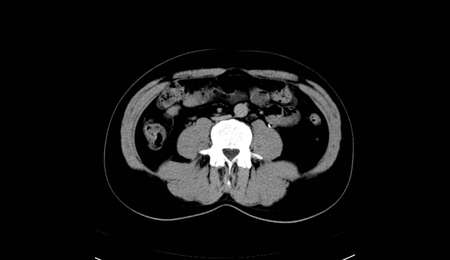 Abdomen human, man, CT scan