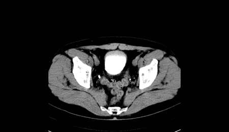 Abdomen human, man, CT scanの写真素材