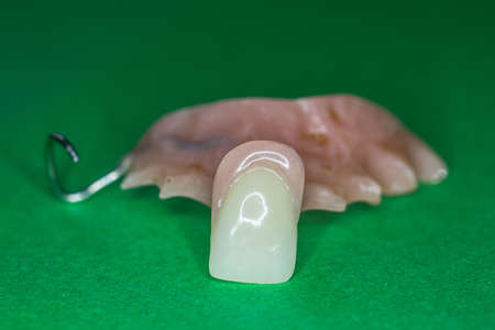 Upper jaw prosthesis with dentures