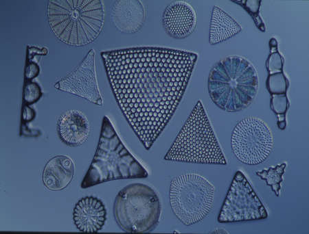 Diatoms from the sea under the microscope 100x