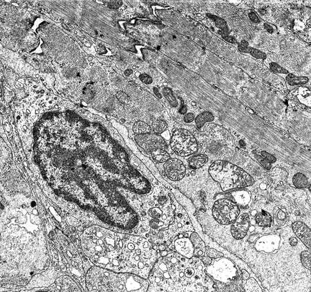 Cell nucleus and organelles under the electron microscope 50,000x