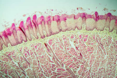 Tongue Tissue with taste buds across 100x