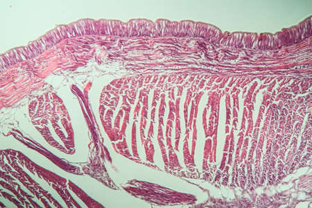 Earthworm histology cross section 10th segment 100xの写真素材