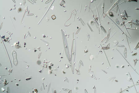 different types of Kiersel algae from the Main Danube Canal, 200x