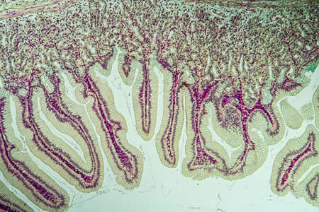 Large intestine with diverticular tissue under the microscope 100xの写真素材