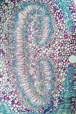Eucalyptus cross section through leaf 100x