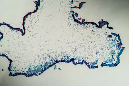 Cross-section through the lichen symbiote body 100x