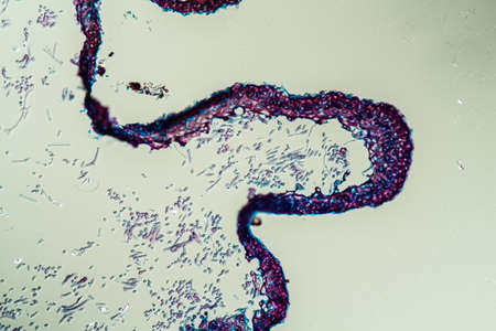 Cross-section through the lichen symbiote body 200x