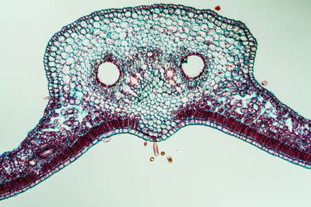 Ivy leaf in cross section 100x