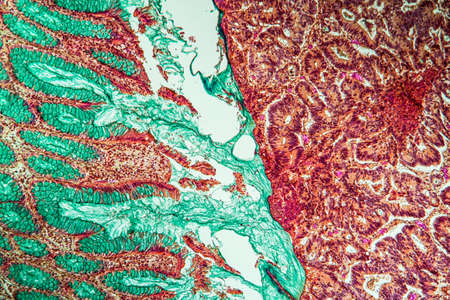 Intestine with villi and goblet cells Carcinoma tissue section 100xの写真素材