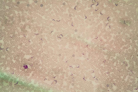 Trypanosomes of Chagas disease parasites in the blood 400x