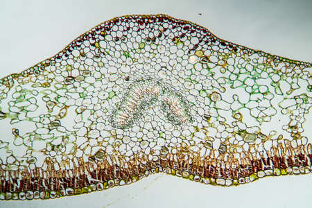 Gentian leaf in cross section 200x