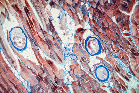 Trichinic parasites in muscle tissue 100xの写真素材