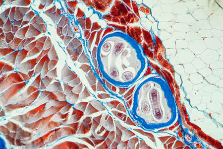 Trichinic parasites in muscle tissue 100xの写真素材