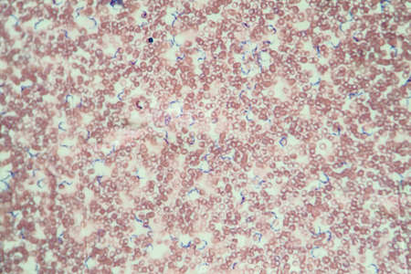 Trypanosomes of Chagas disease parasites in the blood 400x