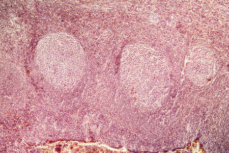 Almond tonsils in cross section under the microscope 100x