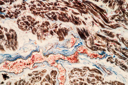 Fat heart tissue under the microscope 200x