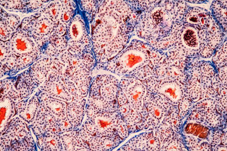 Thyroid tissue under the microscope 200xの写真素材