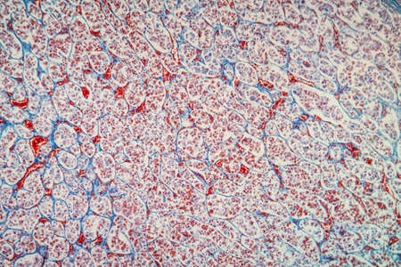 Pituitary tissue under the microscope 100x