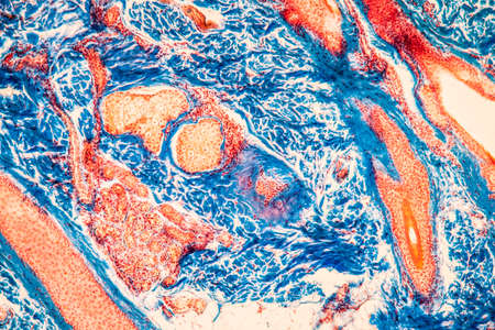 Scalp with hair roots tissue under the microscope 100x