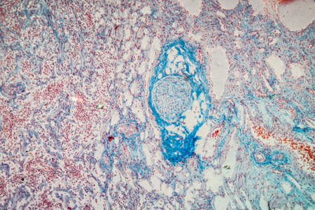 Lymph node tissue under the microscope 100x