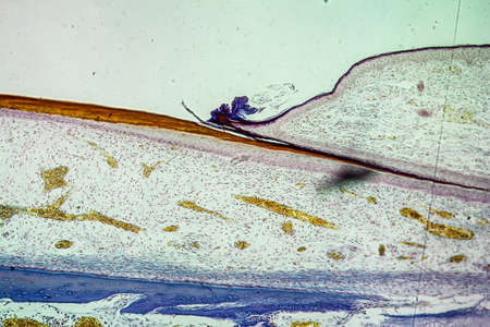 Nail bed tissue under the microscope 100x