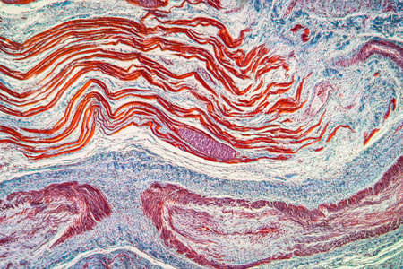 Tapeworm fin parasite in muscle 100x