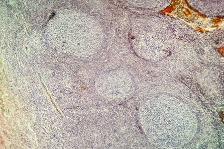 Palatal tonsils transverse 100x under a microscope