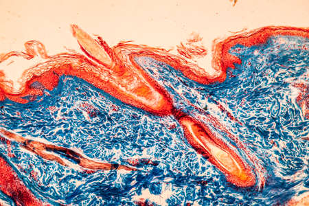 Scalp with hair roots tissue under the microscope 100x