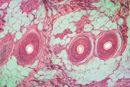 Scalp with hair across 100x