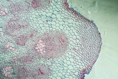 Burdock with stalk across 100xの写真素材