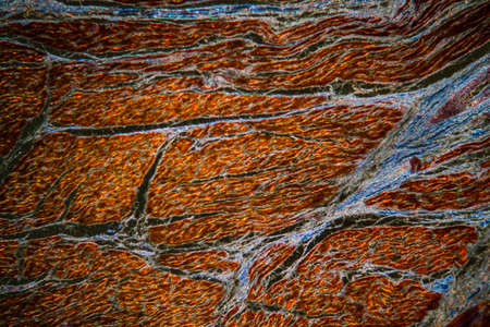 Muscle tissue with collagen increases 100x