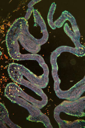 Horse chestnut buds in cross section 100x