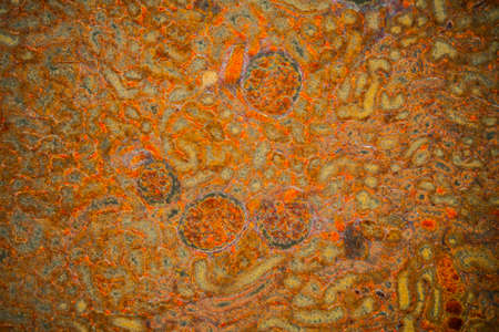 Kidney tissue with kidney corpuscles with jaundice jaundice 100x