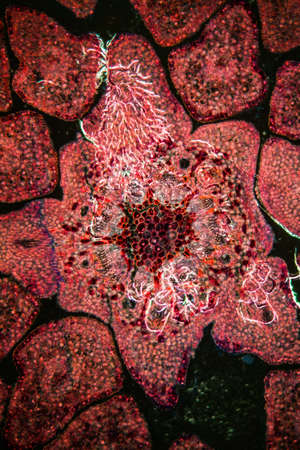 Spruce shoots in cross section under the microscope 100x