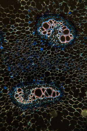 Bracken trunk in cross section 100x
